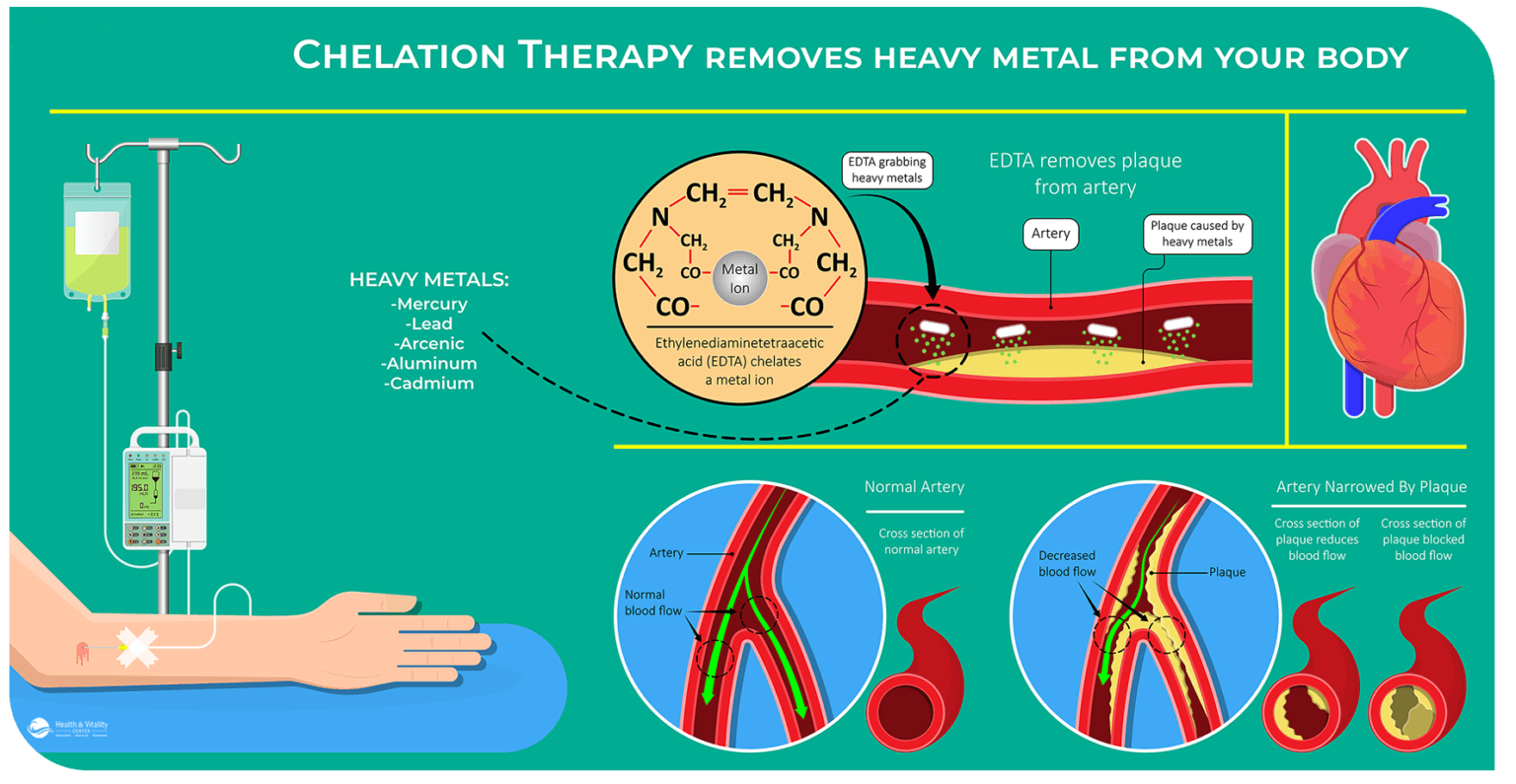 IV Chelation Therapy - Heavy Metal Treatment - Dr. Lalezar