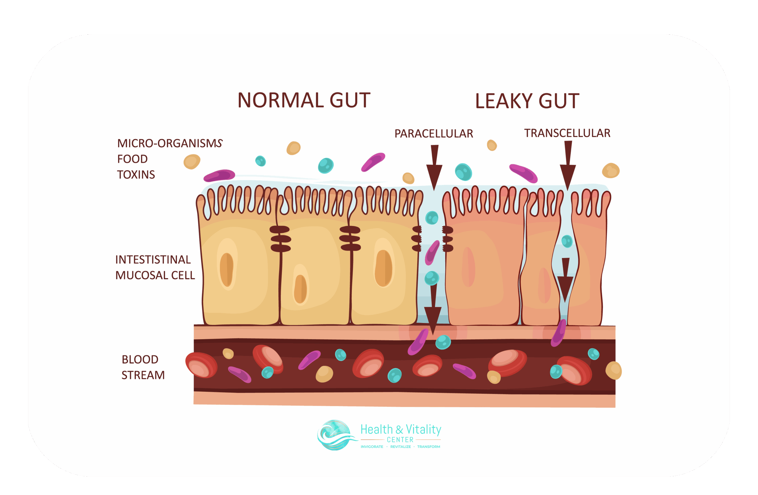 Autoimmune Disorders