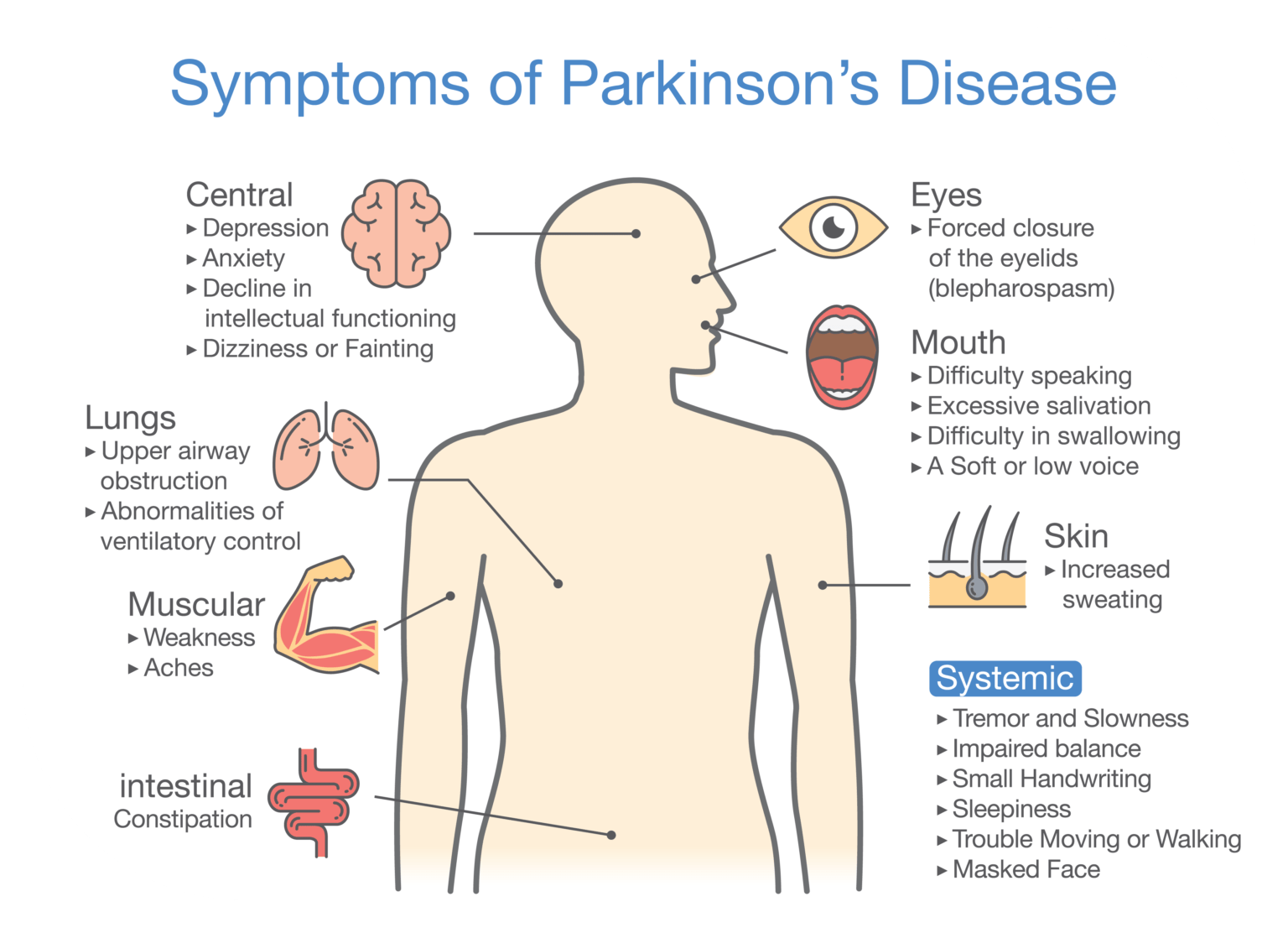 IV Glutathione For Parkinson's Disease | Dr. Shiva Lalezar